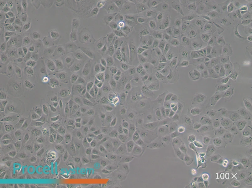 NIH:OVCAR-3 [OVCAR3] Cell Complete Medium - 2