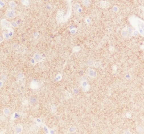 Recombinant GABA A Receptor alpha 1 Monoclonal Antibody - 2