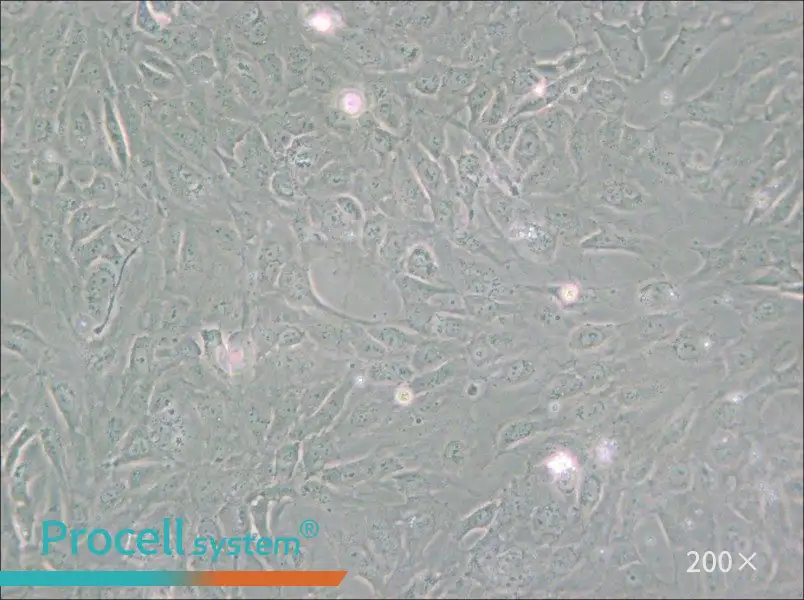 PUMC-HUVEC-T1 Cell Complete Medium - small - 4