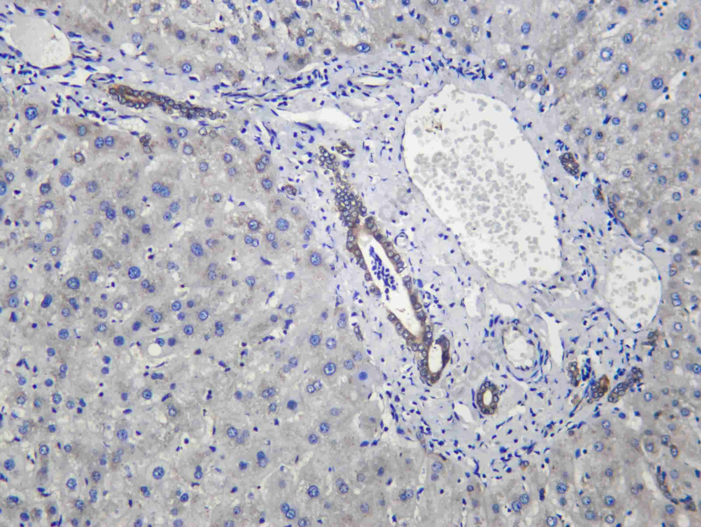 Recombinant DAP 1 Monoclonal Antibody - 2