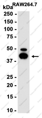 Recombinant VEGFA Monoclonal Antibody - 2