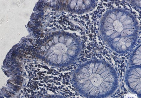 Recombinant Hsc70 Monoclonal Antibody - 5