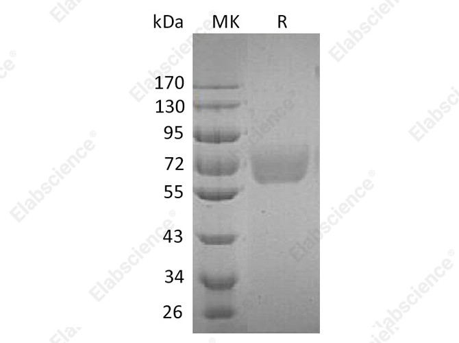 Recombinant Human IL4RA/CD124 Protein (Fc Tag) - 1