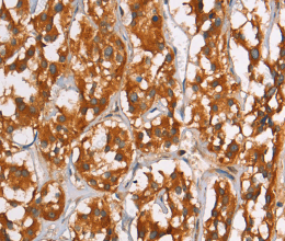 PLIN2 Polyclonal Antibody - 2