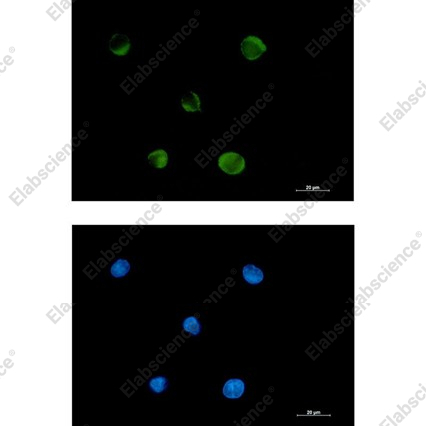 Recombinant FADS1 Monoclonal Antibody - 3
