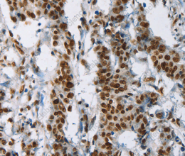IL17C Polyclonal Antibody - 2