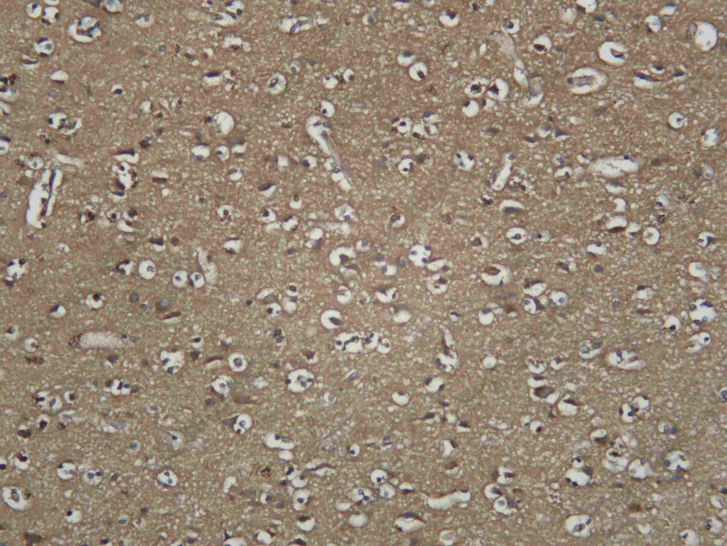 Recombinant C3 Monoclonal Antibody - 1