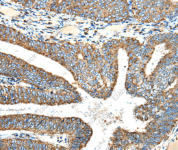 NDUFA5 Polyclonal Antibody - 2