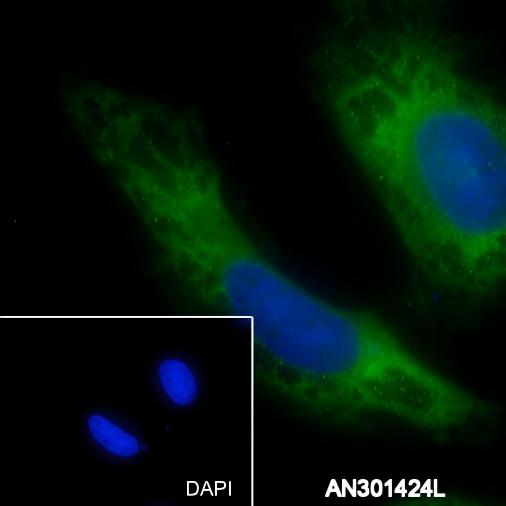 Recombinant ABCE1 Monoclonal Antibody - small - 2