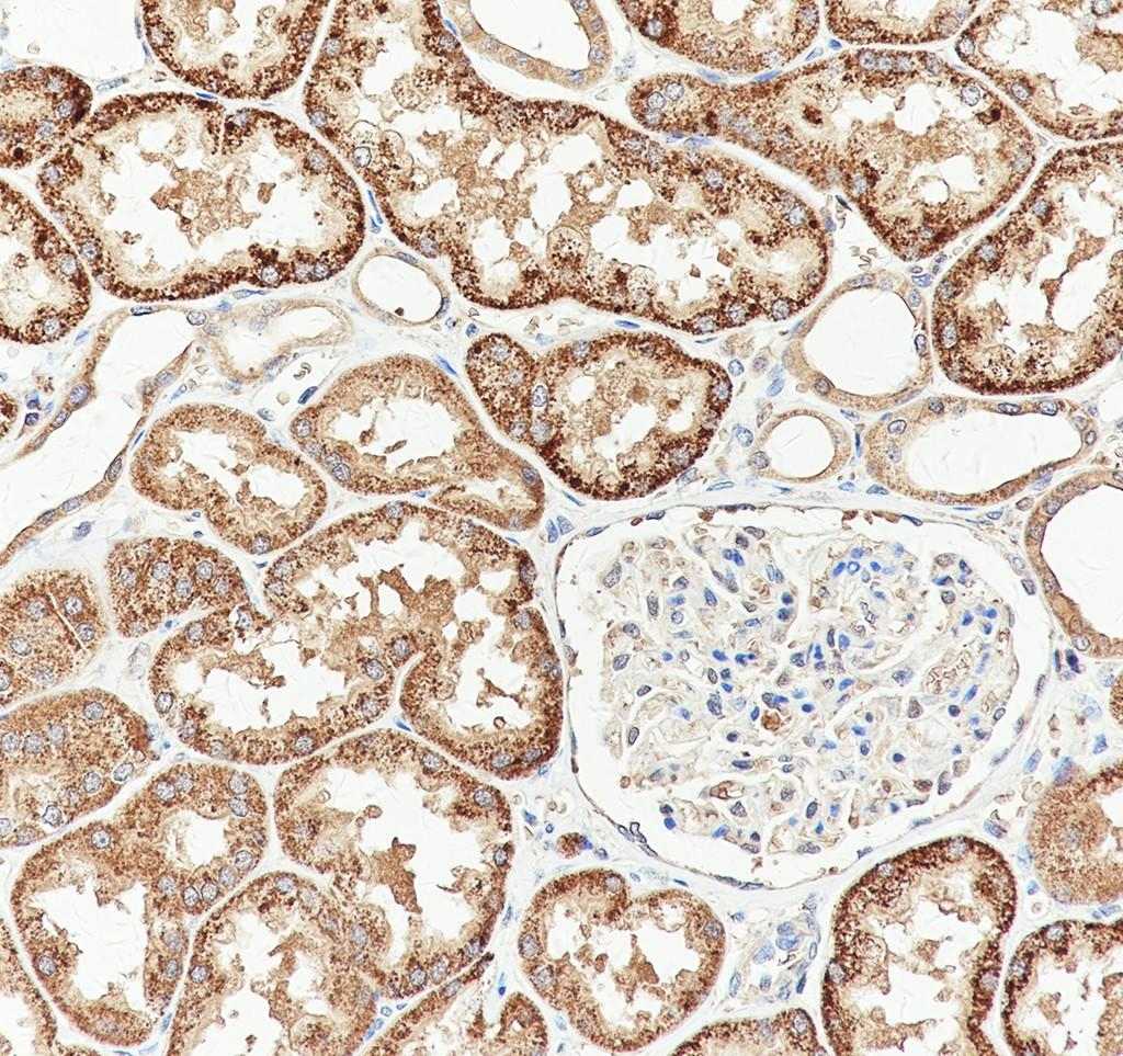 Recombinant EID1 Monoclonal Antibody - small - 3