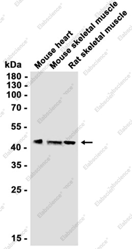 Recombinant MAPKAP Kinase 2 Monoclonal Antibody - 2