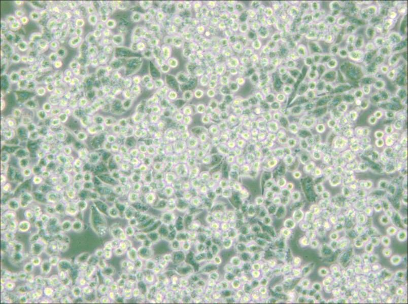 MIA PaCa-2 Cell Complete Medium - small - 6