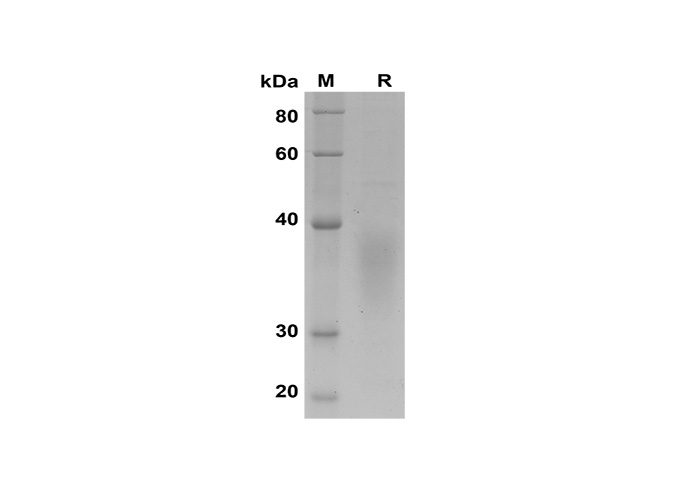 Recombinant Rat IL-4 Protein-产品推荐-8