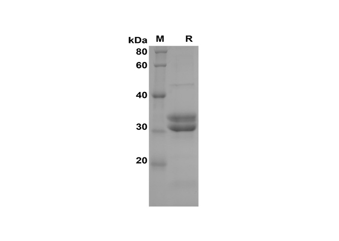 Recombinant Human FGF21 Protein (His Tag)-产品推荐-1