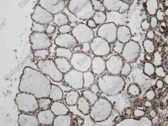 Recombinant Midkine Monoclonal Antibody - 2