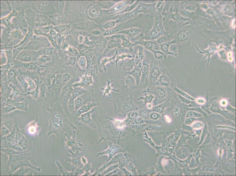 NCI-H1568 [H1568] Cell Complete Medium - small - 5