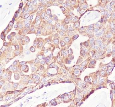 Recombinant PTP1B Monoclonal Antibody - 2