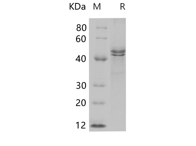 Recombinant Mouse IL-17A Protein(Sumo Tag)-产品推荐-1
