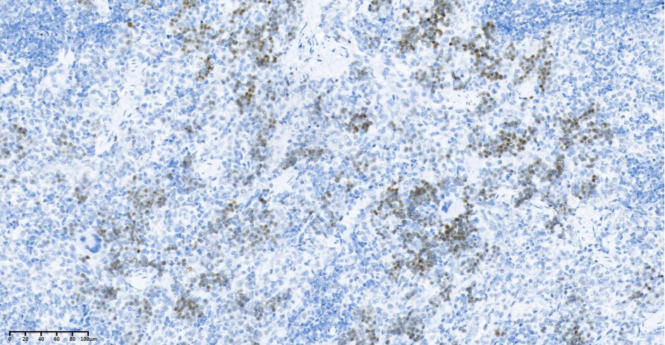 Recombinant Ki67 Monoclonal Antibody - small - 4