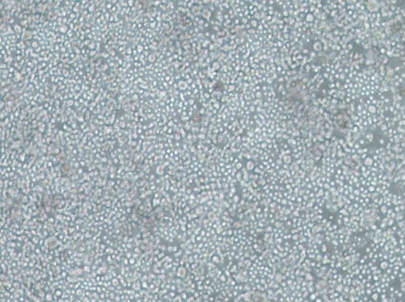 SU-DHL-2 Cell Complete Medium - 2