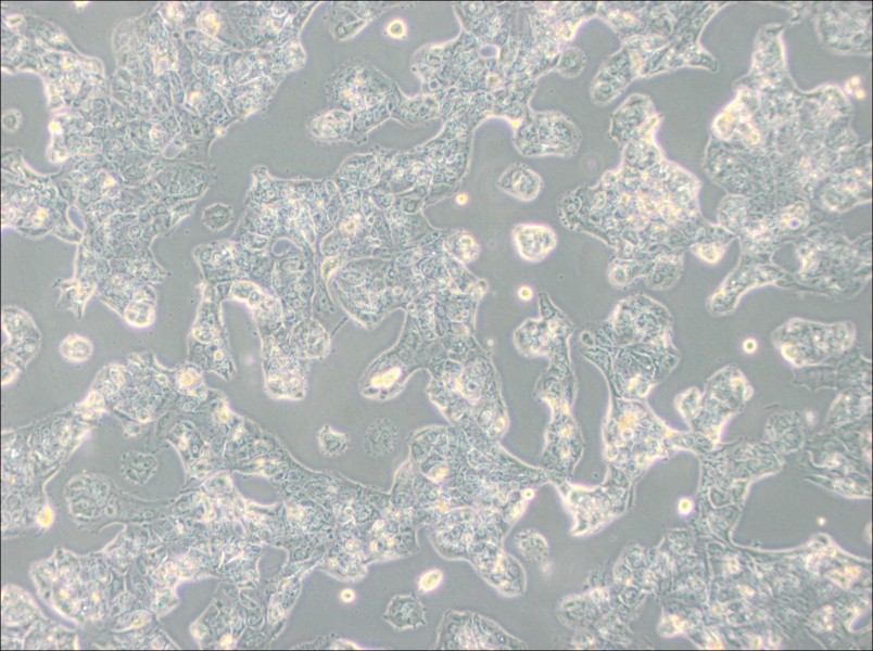 MDA-MB-175VII (L15) Cell Complete Medium-searchlist-1