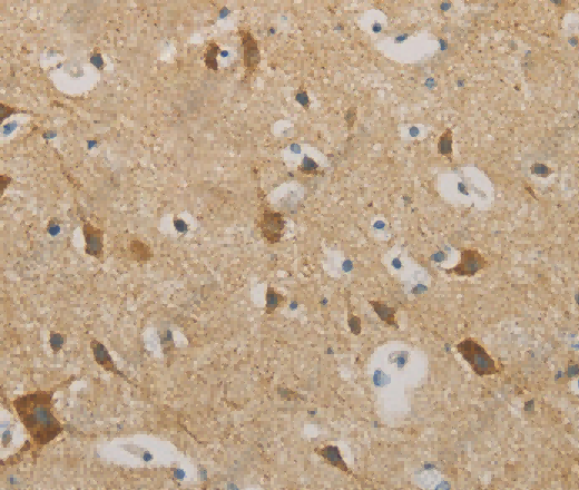IDH3G Polyclonal Antibody - 2