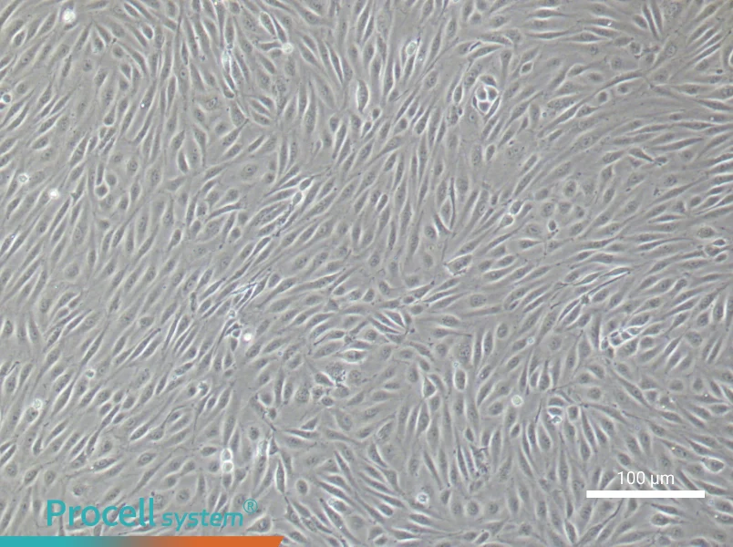 Human Umbilical Vein Endothelial Cell Complete Medium - small - 5