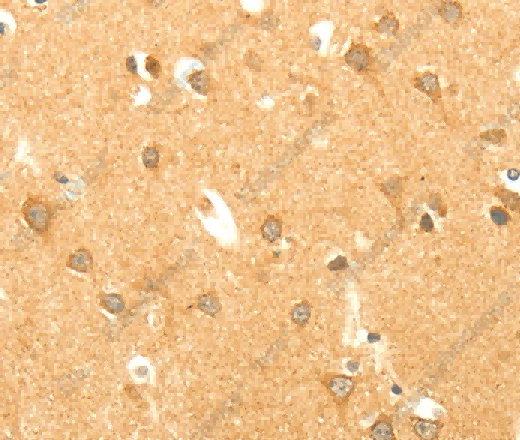 AARS2 Polyclonal Antibody - 3