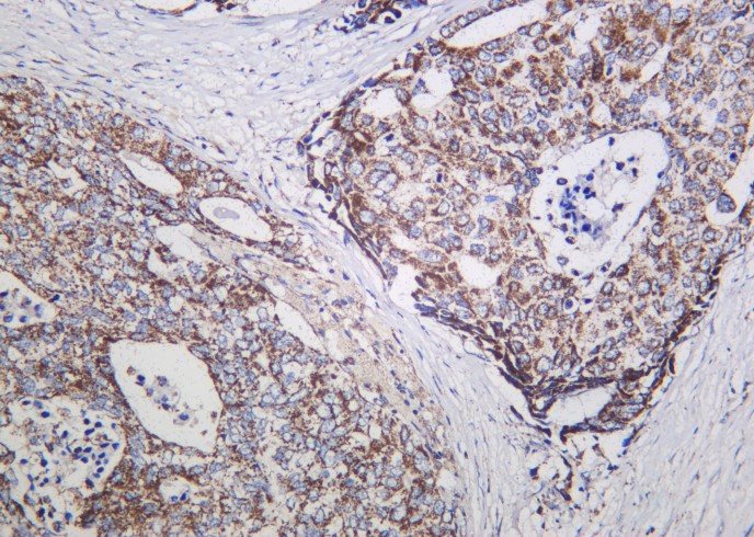 Recombinant NDUFS1 Monoclonal Antibody-searchlist-1