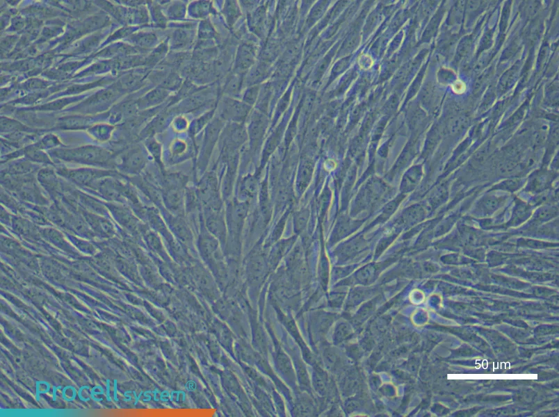 Human Cardiac Fibroblast (Primary cell immortalization) Complete Medium - 4