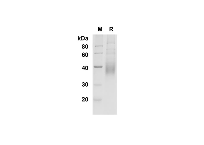 Recombinant Rat Interleukin-12/IL-12 Protein (His Tag)-产品推荐-1