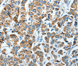 ALDH4A1 Polyclonal Antibody - 2