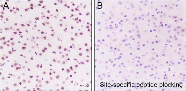 Recombinant Histone H3 (Acetyl Lys122) Monoclonal Antibody - small - 7