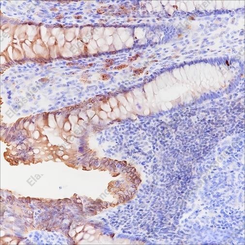 Recombinant c-erbB-3/HER-3 Monoclonal Antibody - 1