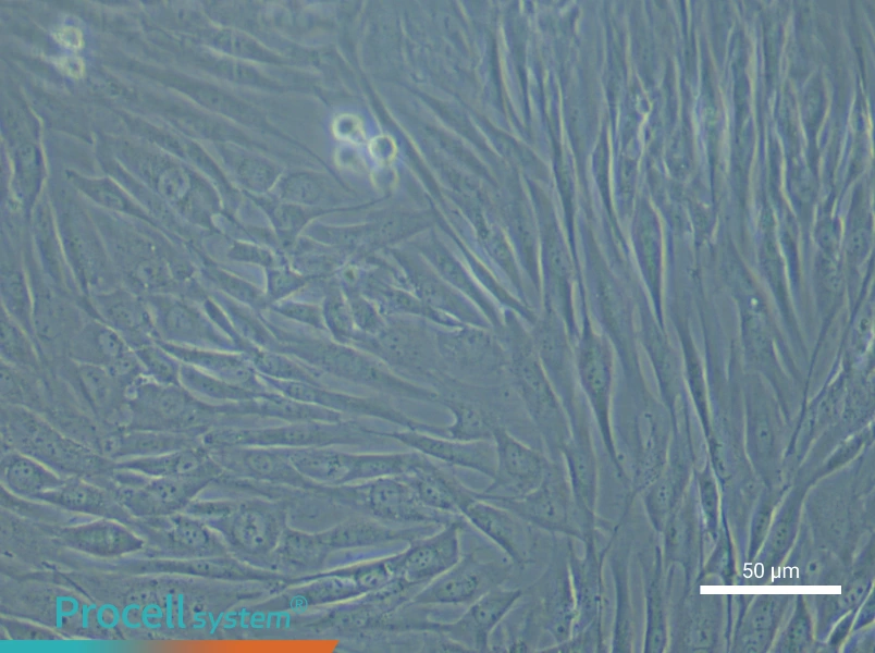 Human Intervertebral Disc Nucleus Pulposu (Primary cell immortalization) Cell Complete Medium - small - 4