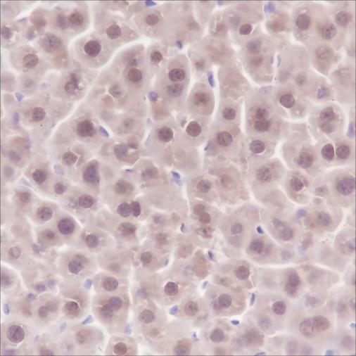 Recombinant SOD1 Monoclonal Antibody - small - 4