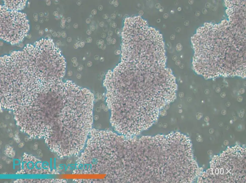 NCI-H1417 Cell Complete Medium - 1