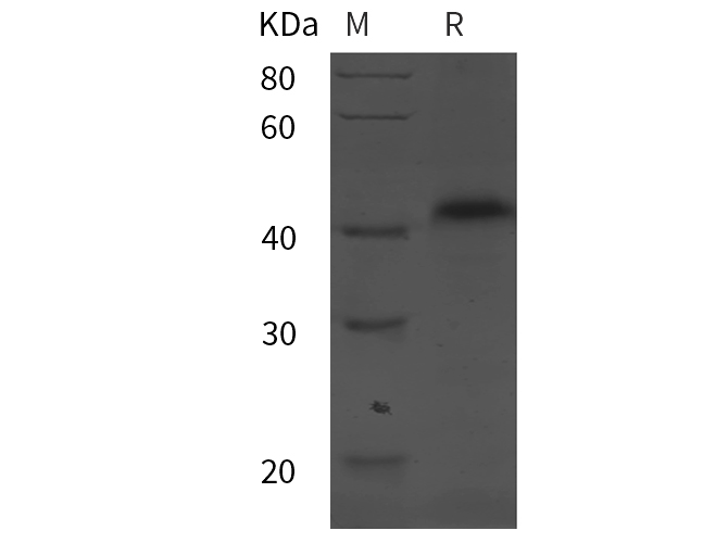 Recombinant Human CSF2 Protein-产品推荐-1
