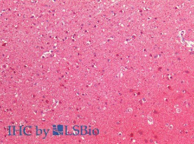 Purified Anti-Human CD161 Antibody[HP-3G10]-产品推荐-1