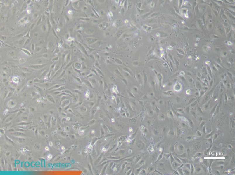 Human Umbilical Vein Endothelial (Primary cell immortalization) Cell Complete Medium - 3