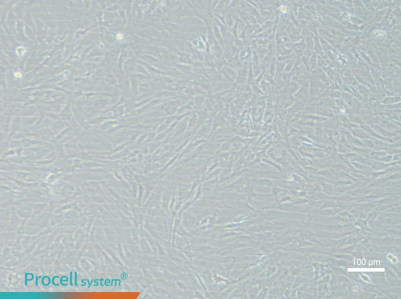 Rat Chondrocytes (Primary cell immortalization)Rat Chondrocytes (Primary cell immortalization) - 1
