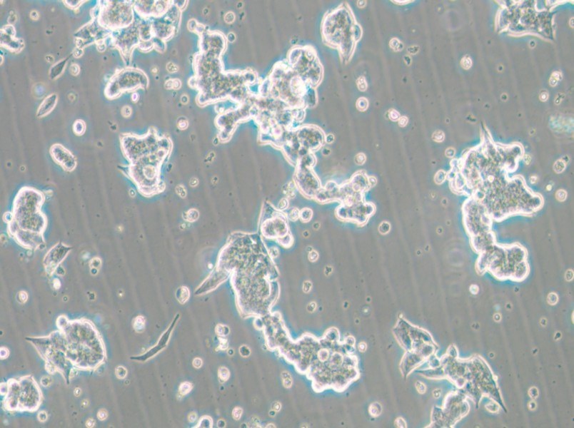 NCI-H209 [H209] Cell Complete Medium - small - 5