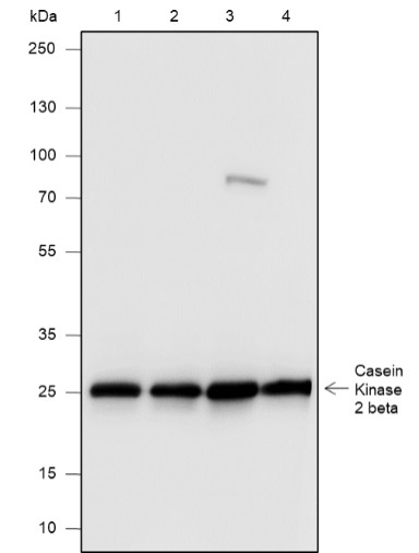 Recombinant Casein Kinase 2 beta Monoclonal Antibody-searchlist-1