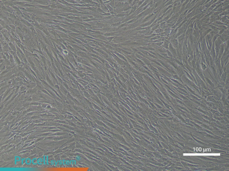 Human Bronchial Smooth Muscle Cell Complete Medium - 1