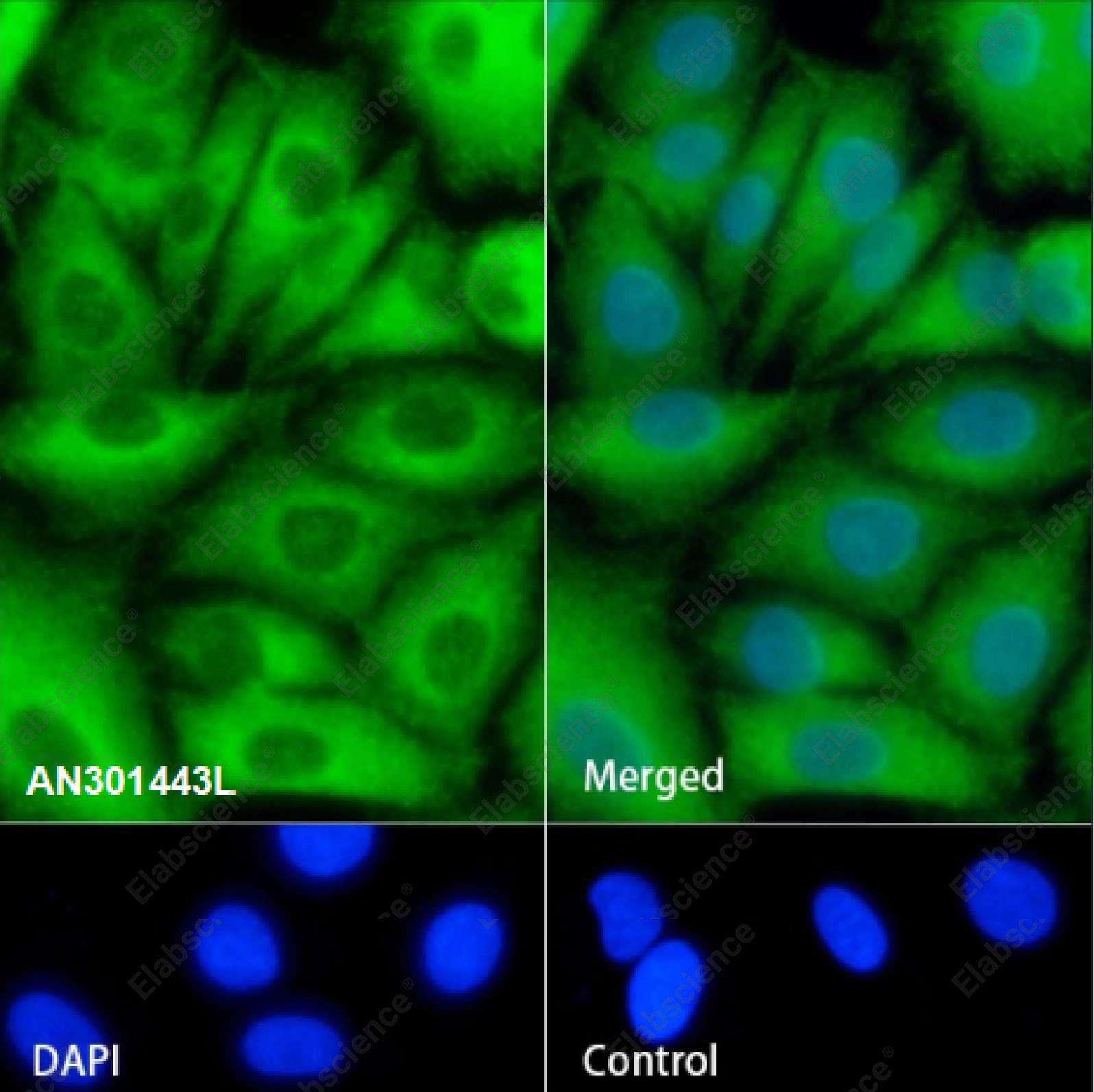Recombinant BAP31 Monoclonal Antibody - 5