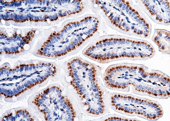 Recombinant Carbonic Anhydrase XII/Car12 Monoclonal Antibody - small - 2