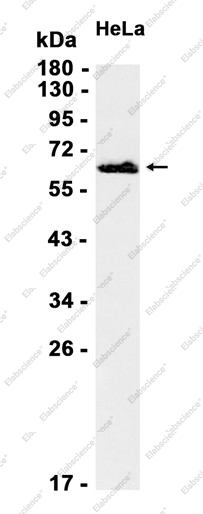 Recombinant Extracellular matrix protein 1 Monoclonal Antibody - 1