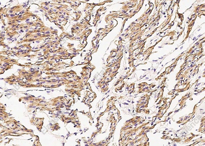 Desmin Monoclonal Antibody - 1