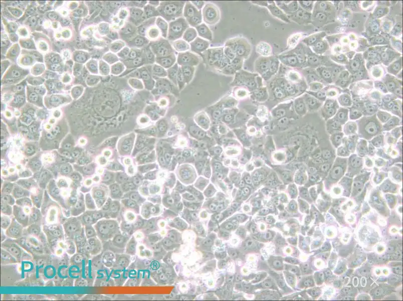 NCI-H2126 Cell Complete Medium - small - 5