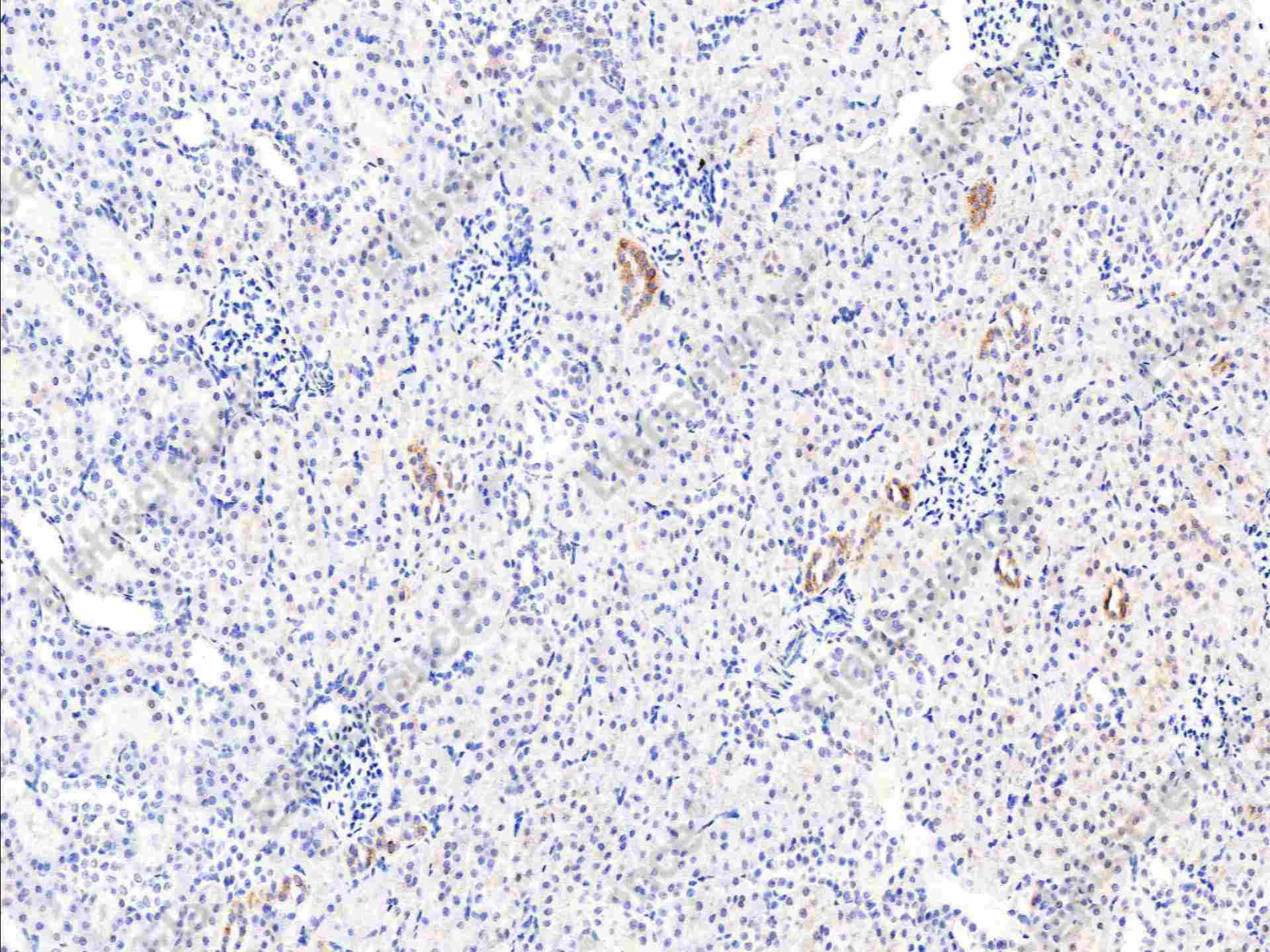 Recombinant EGFR/HER1/ErbB1 Monoclonal Antibody - 3